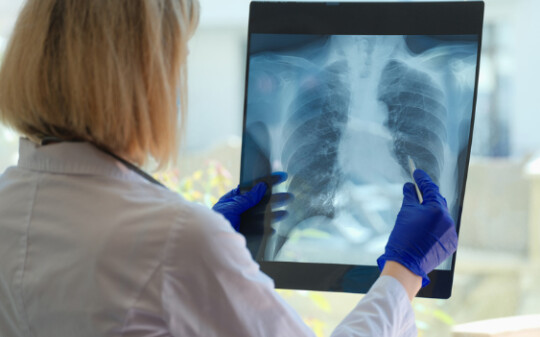 Vybrané dýchací choroby jako nemoc z povolání